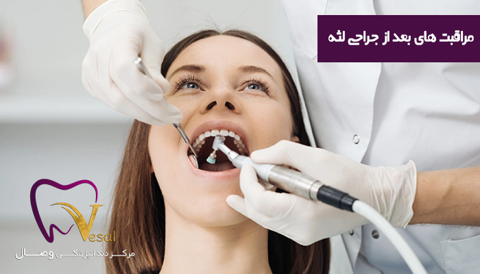 مراقبت های بعد از جراحی لثه را جدی بگیرید
