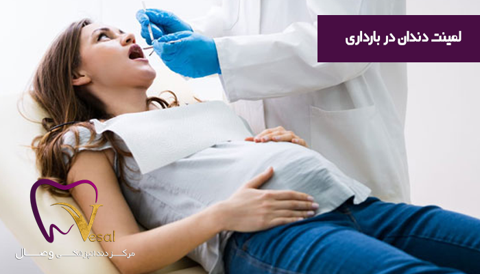 دلایل عدم انجام لمینت دندان در بارداری