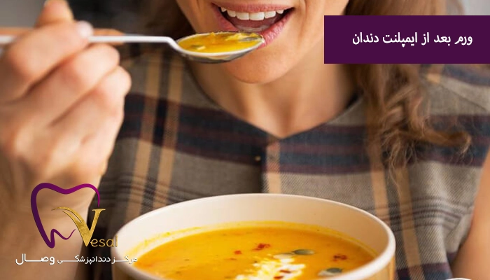 تغذیه مناسب برای کاهش تورم بعد از ایمپلنت