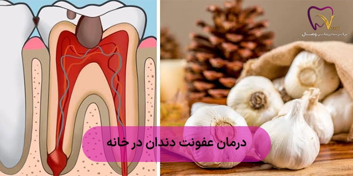 درمان عفونت دندان در خانه